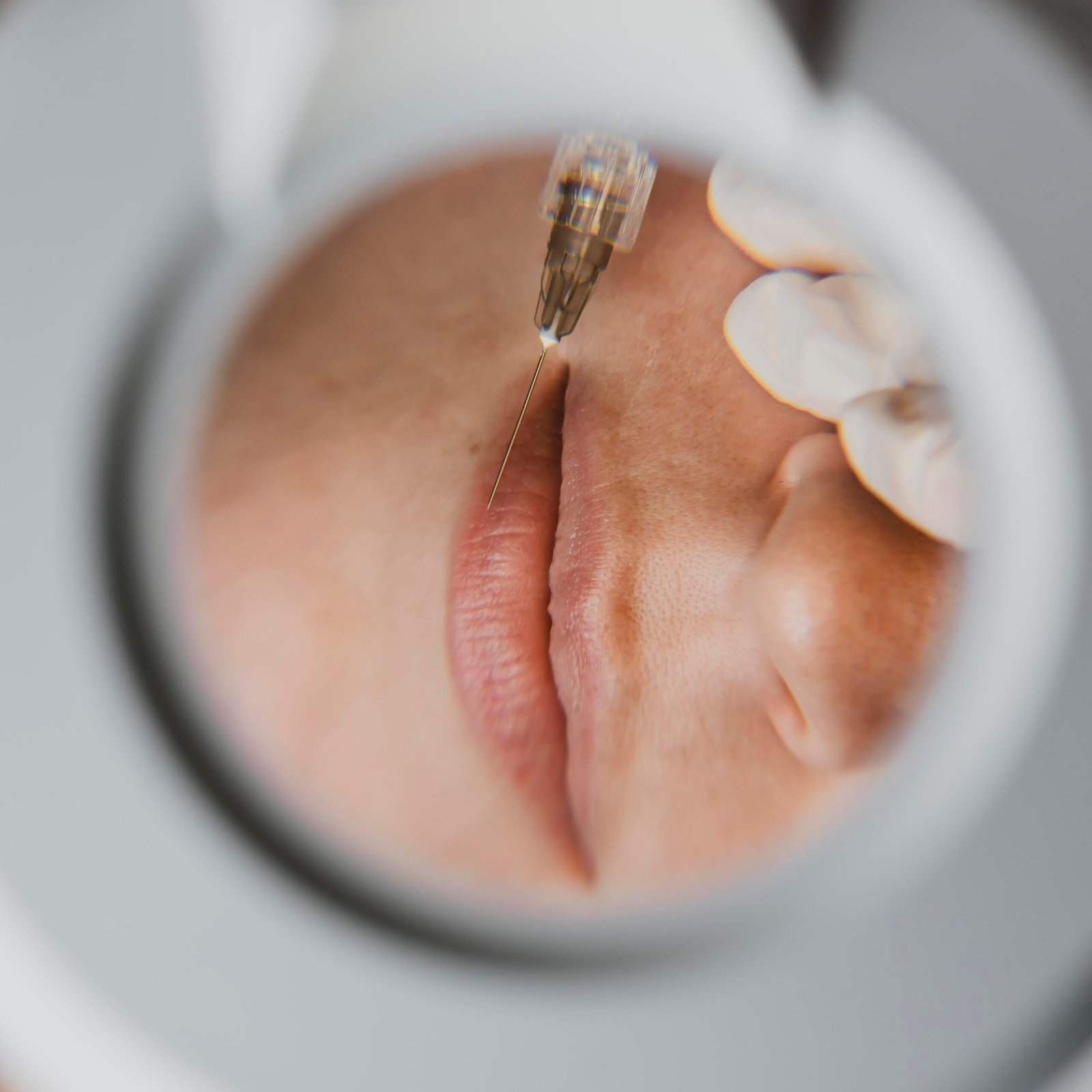 Mujer haciéndose un retoque estético